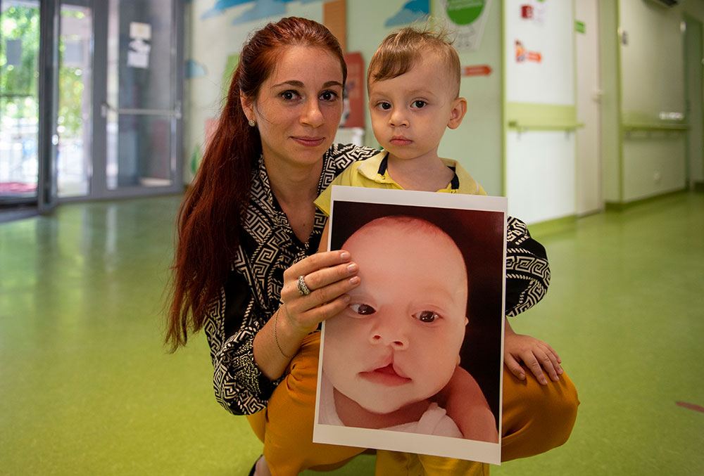 Adelina holding Ionut beside a picture of him before cleft surgery