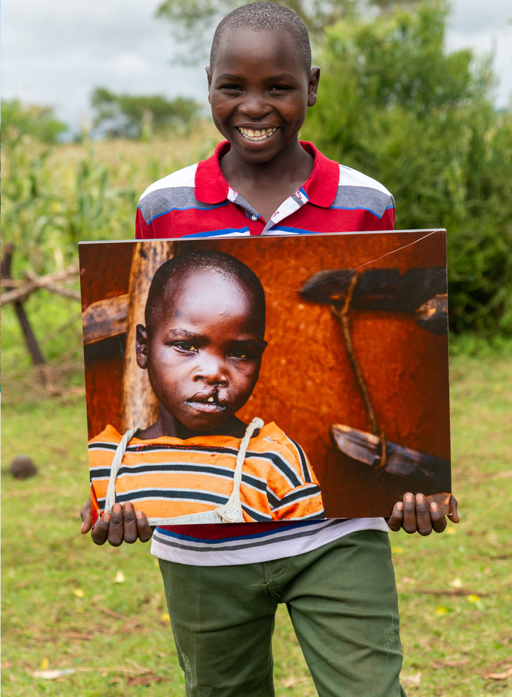 Osawa holding a picture of himself before cleft surgery