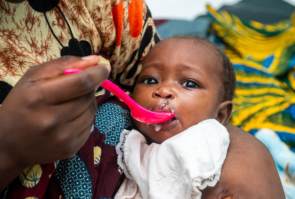 A Smile Train patient receiving nutritional care in Tanzania