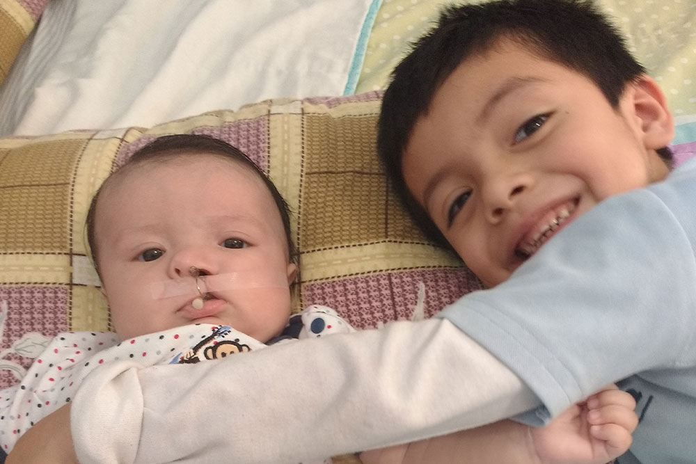 Family support: Alex’s older brother, Carlos, snuggling him before his cleft surgery