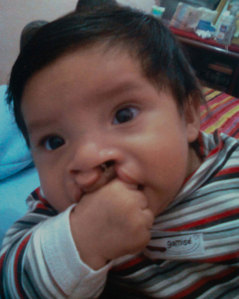 Bautista as a baby, before cleft surgery