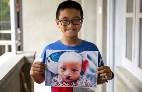 Jenious holding a picture of himself as a baby before cleft surgery